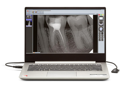 New Life Radiology Mercury DIGISENS - цифровой радиовизиограф с ноутбуком