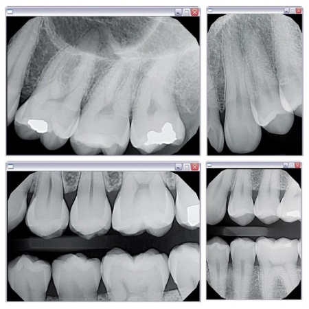 KaVo Gendex GXS-700 - система компьютерной радиовизиографии (сенсор №1)
