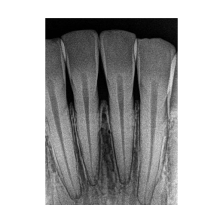 Carestream Kodak RVG 5200 - радиовизиограф