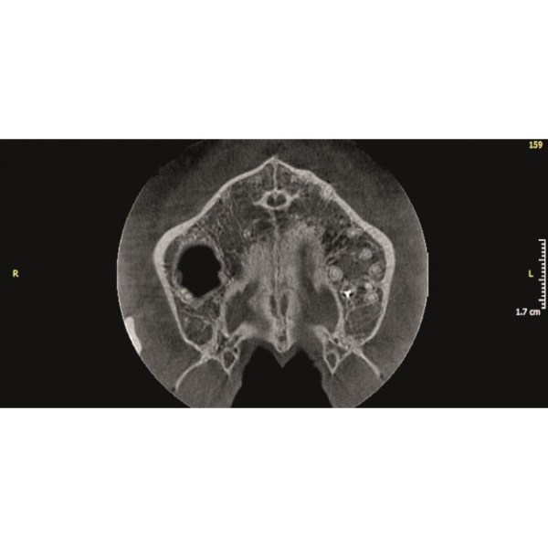 KaVo Pan eXam Plus 2D - датчик для панорамной рентгенодиагностики