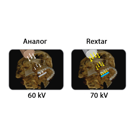 POSDION Rextar - портативный рентген