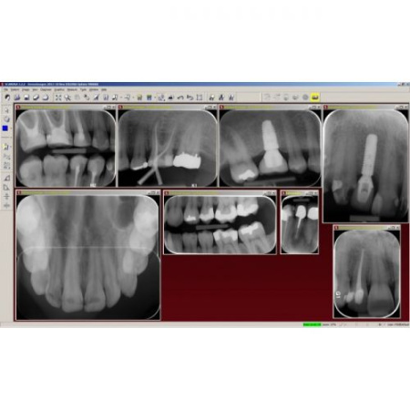 Digora Optime Classic - беспроводной визиограф