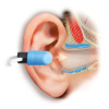 SAM ATB 240 — Фиксирующие колпачки для ушей (200 шт)