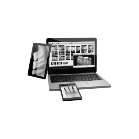 Suni SuniRay2 - система компьютерной радиовизиографии