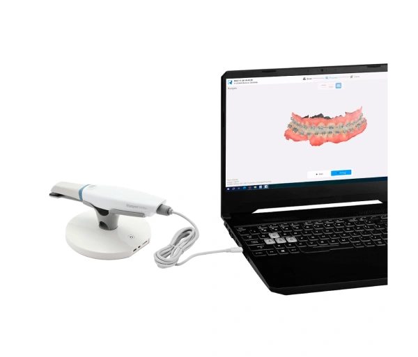 Runyes IOS-11 - интраоральный сканер (Китай / Россия)