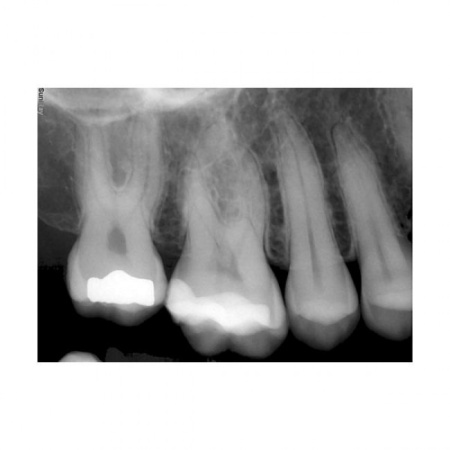 Suni SuniRay2 - система компьютерной радиовизиографии